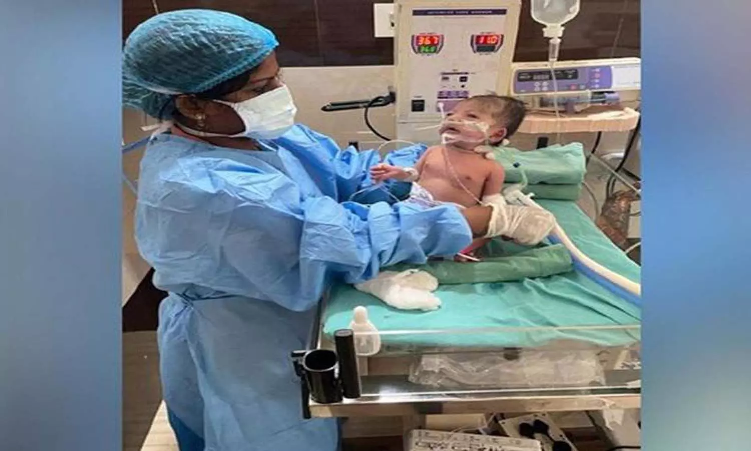 One-month-old beats Covid after 10 days on ventilator in Bhubaneshwar