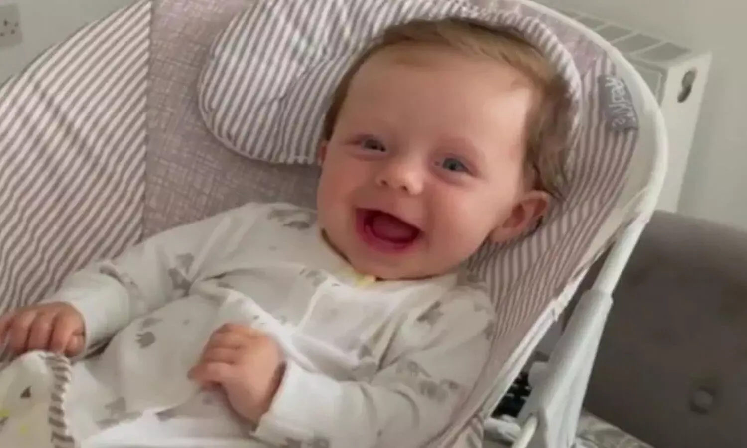 Britain: A 5-month-old toddler turning into STONE, Know about the disease