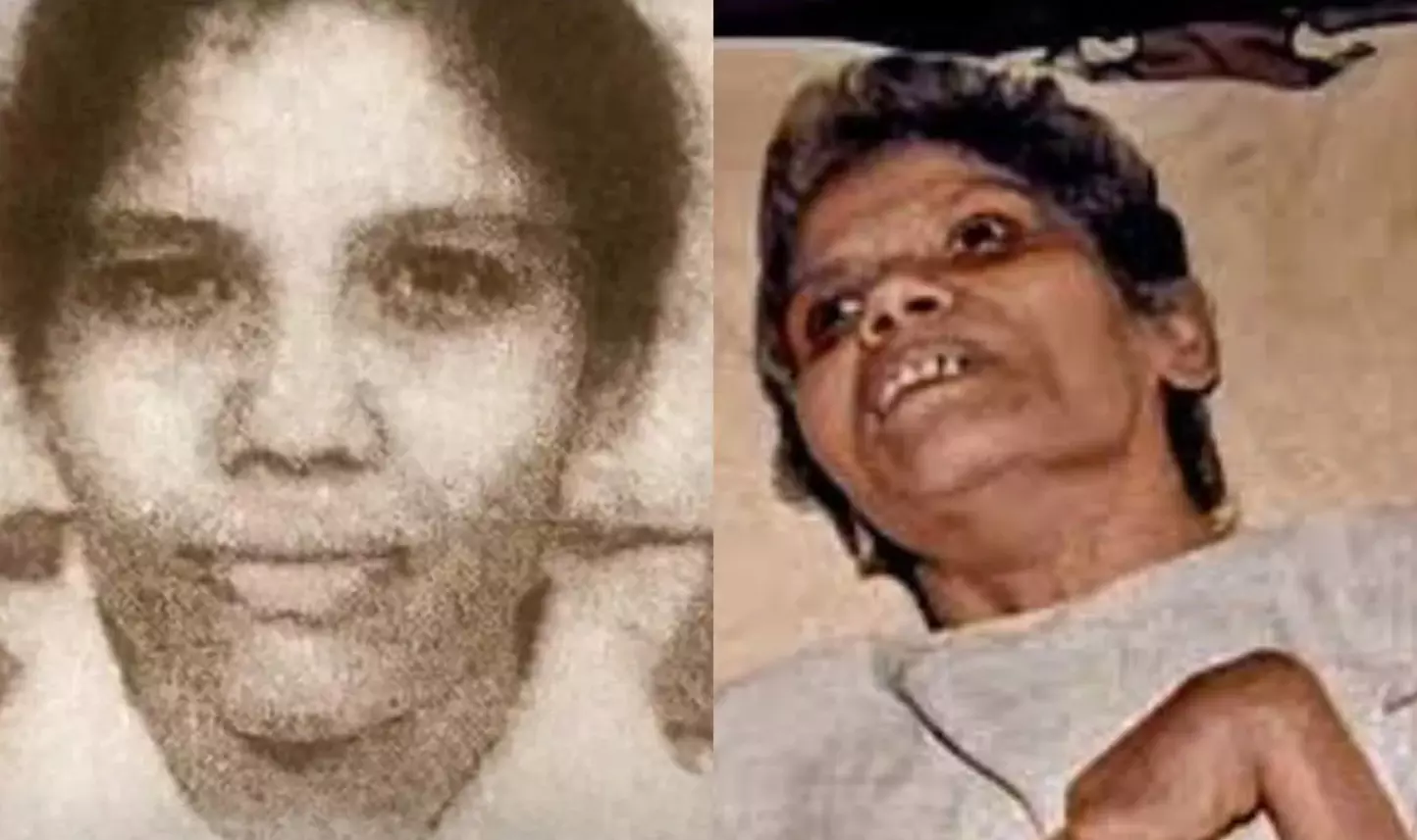 Know what is Aruna Shanbaug case? Why is it being discussed after Kolkata rape and murder case