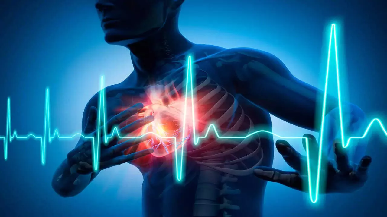 Cardiac Arrest