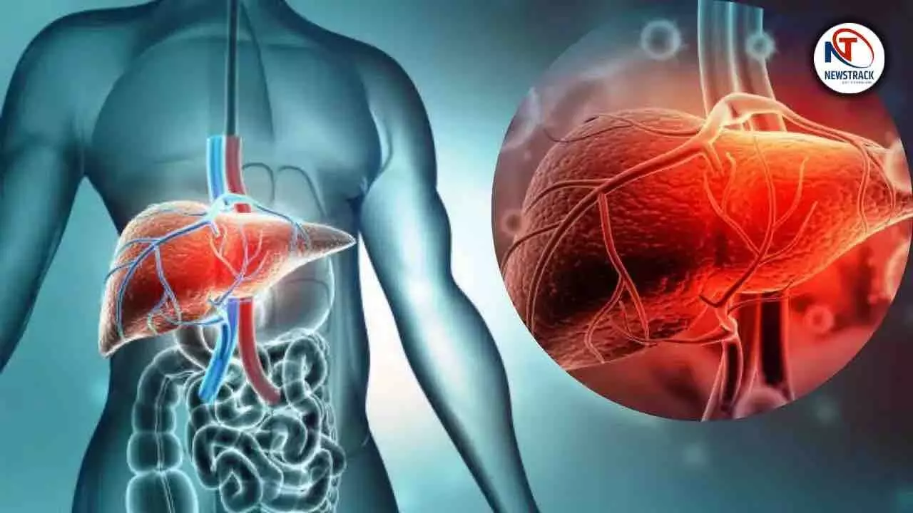 This Disease Is Silently Destroying the Liver 99 Percent People Ignore It