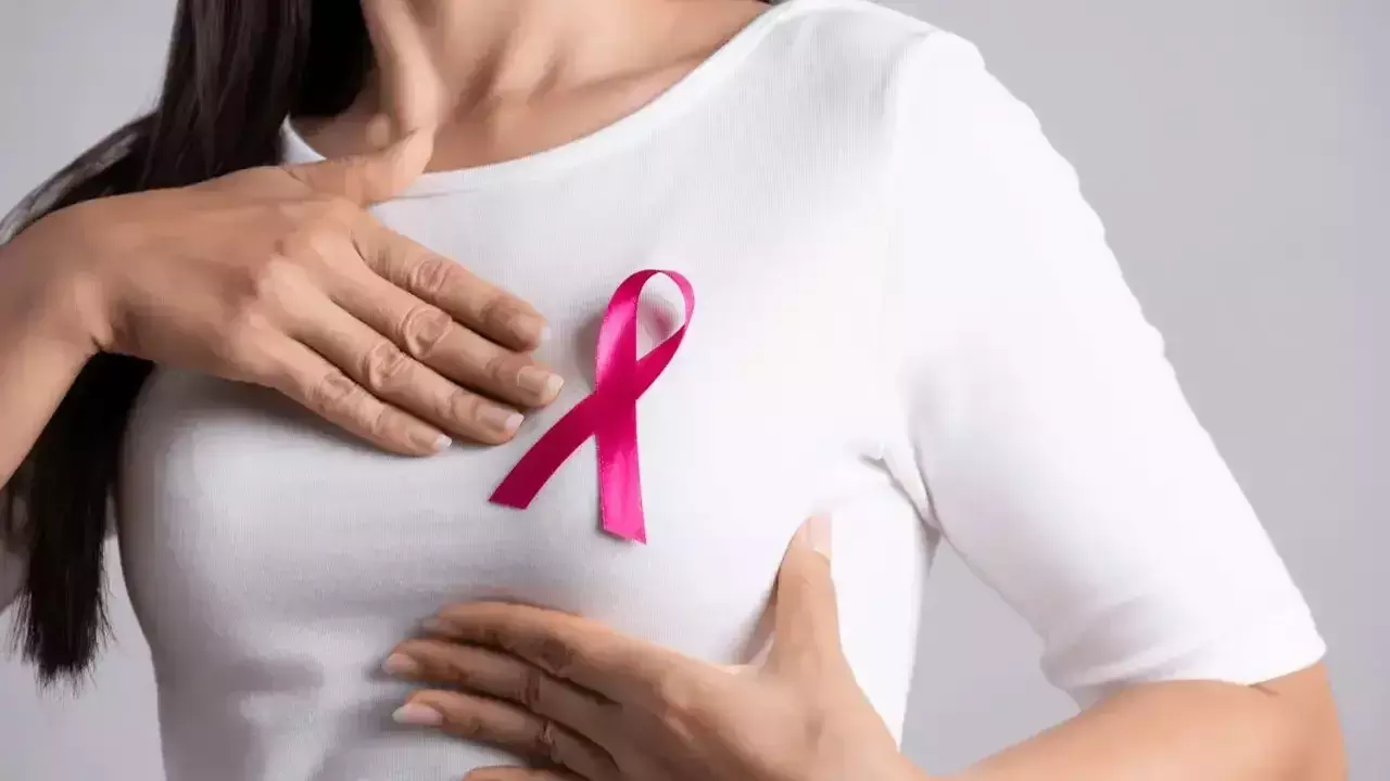Breast Cancer