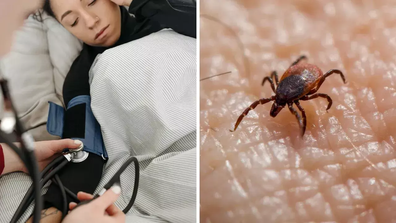 Scrub typhus Scrub typhus