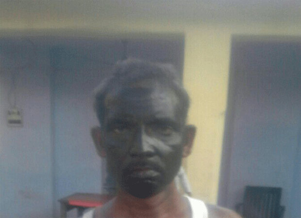 Face of a Bareilly villager blackened