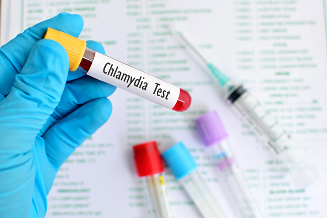 Gut exposure to chlamydia may reduce gut infection