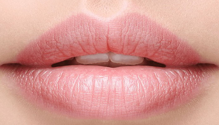 These simple home remedies will keep chapped lips at bay
