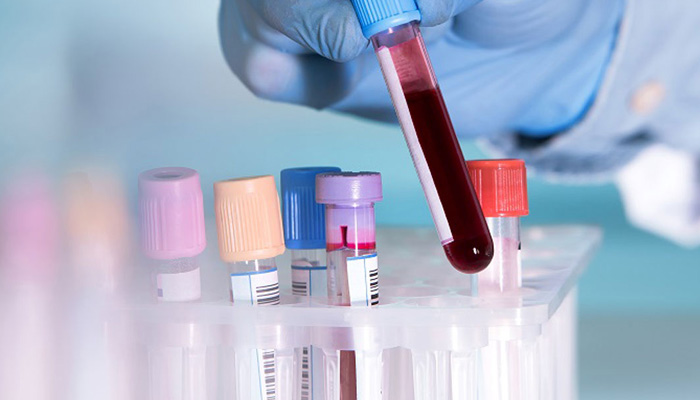 IIT Kharagpur researchers develop low-cost blood test device