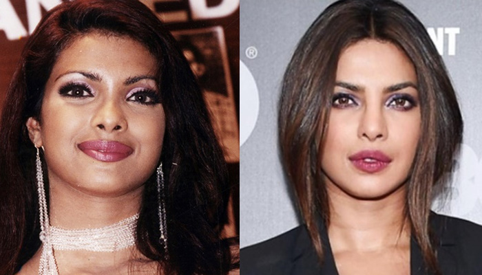 Priyanka Chopra talks about everything she went through in her career