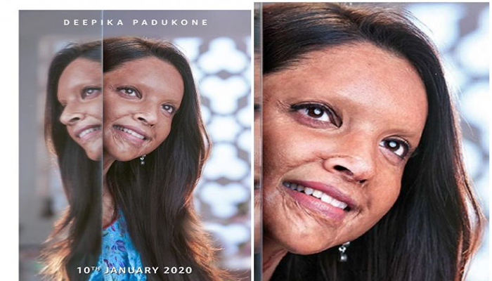 Chhapaak trailer out: Deepika Padukone turns acid survivor Malti to leave us speechless