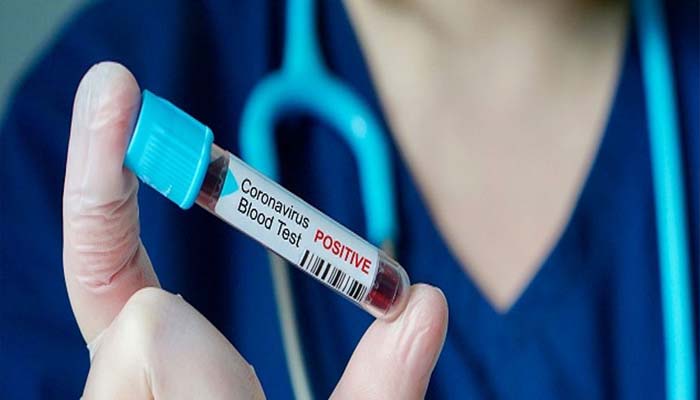 Chandigarh: 21-year-old man tests positive for coronavirus; total cases rise to 7