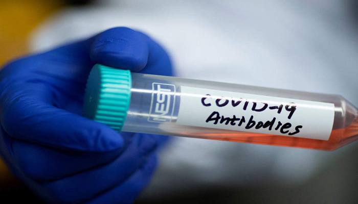 Recently recovered COVID-19 patients produce virus-specific antibodies