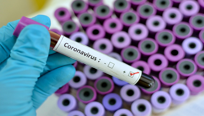 Pak registers 1,446 new coronavirus cases; total count crosses 59,000-mark