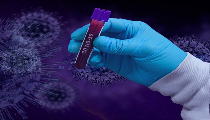 Global Report of COVID-19: Near 27 Million Confirmed Cases of the Novel Coronavirus
