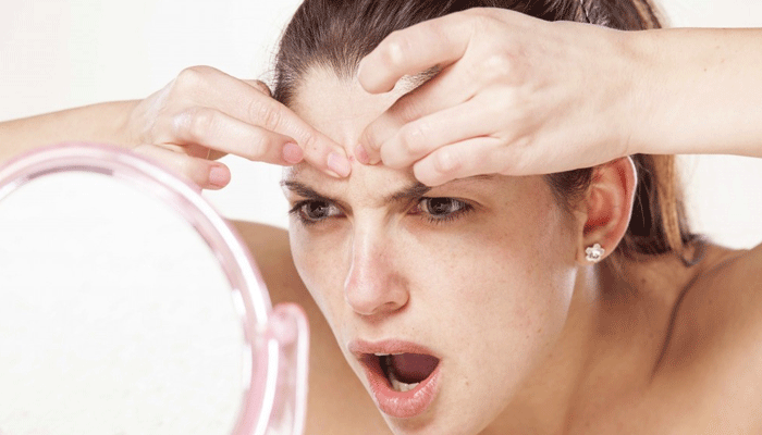 Tired of those oily pimples...? Check out these quick home remedies!