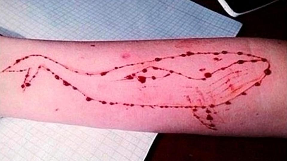 Teenager commits suicide in MP; Blue Whale case suspected