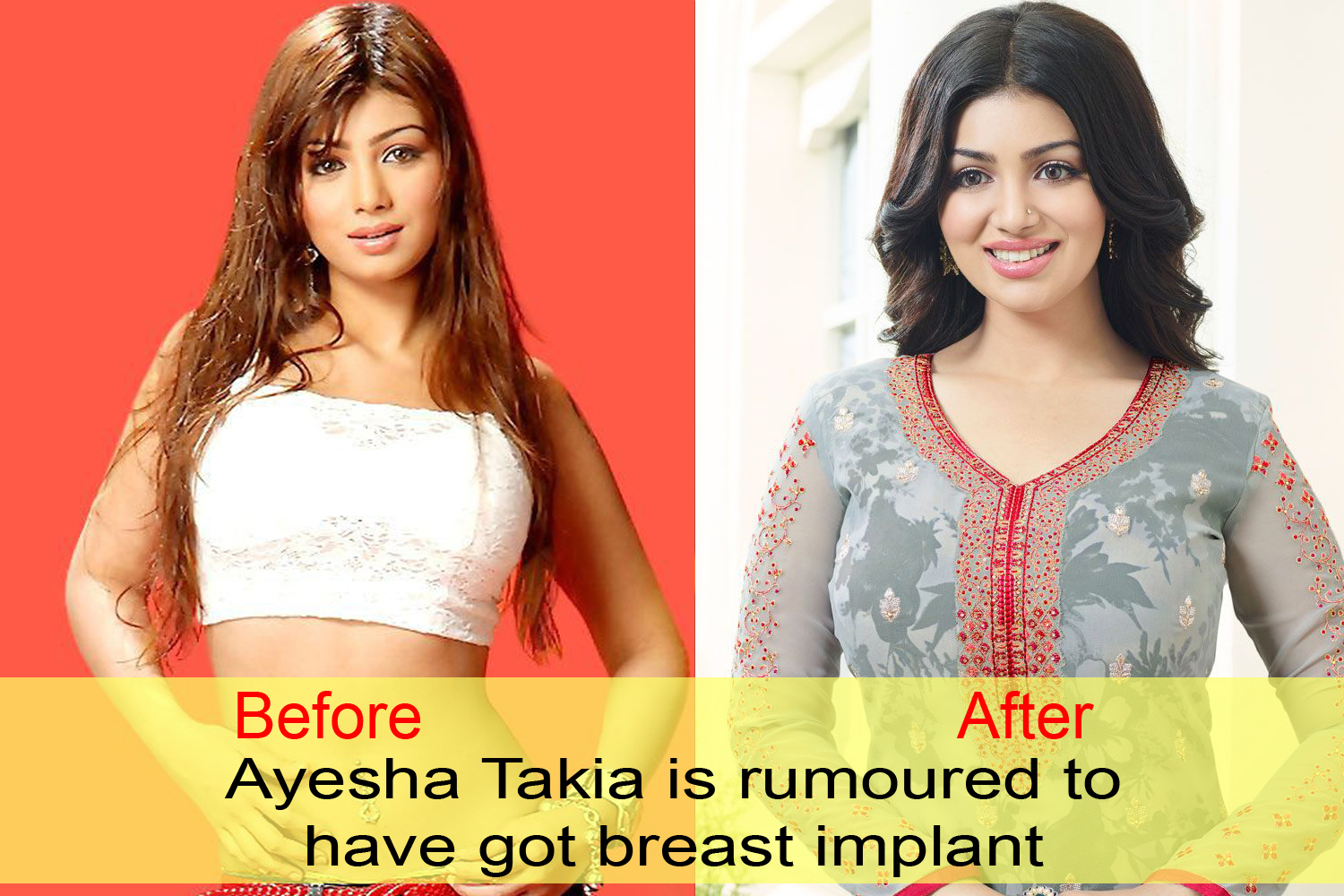 10 Bollywood celebs who went too far with plastic surgeries