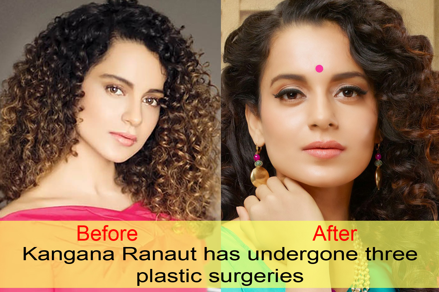 Plastic Surgery