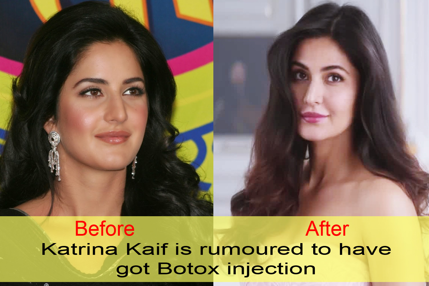 10 Bollywood Celebrities Before And After Plastic Surgery