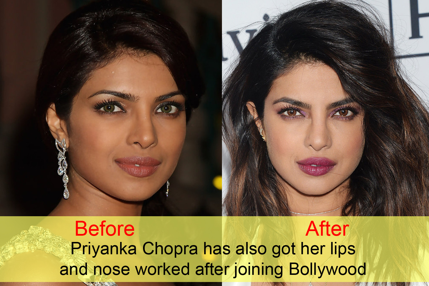 10 Bollywood Celebrities Before And After Plastic Surgery